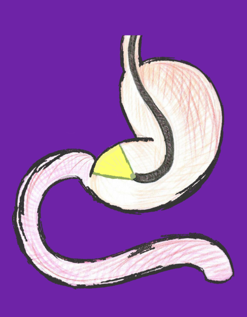 1_gastro_colon_2